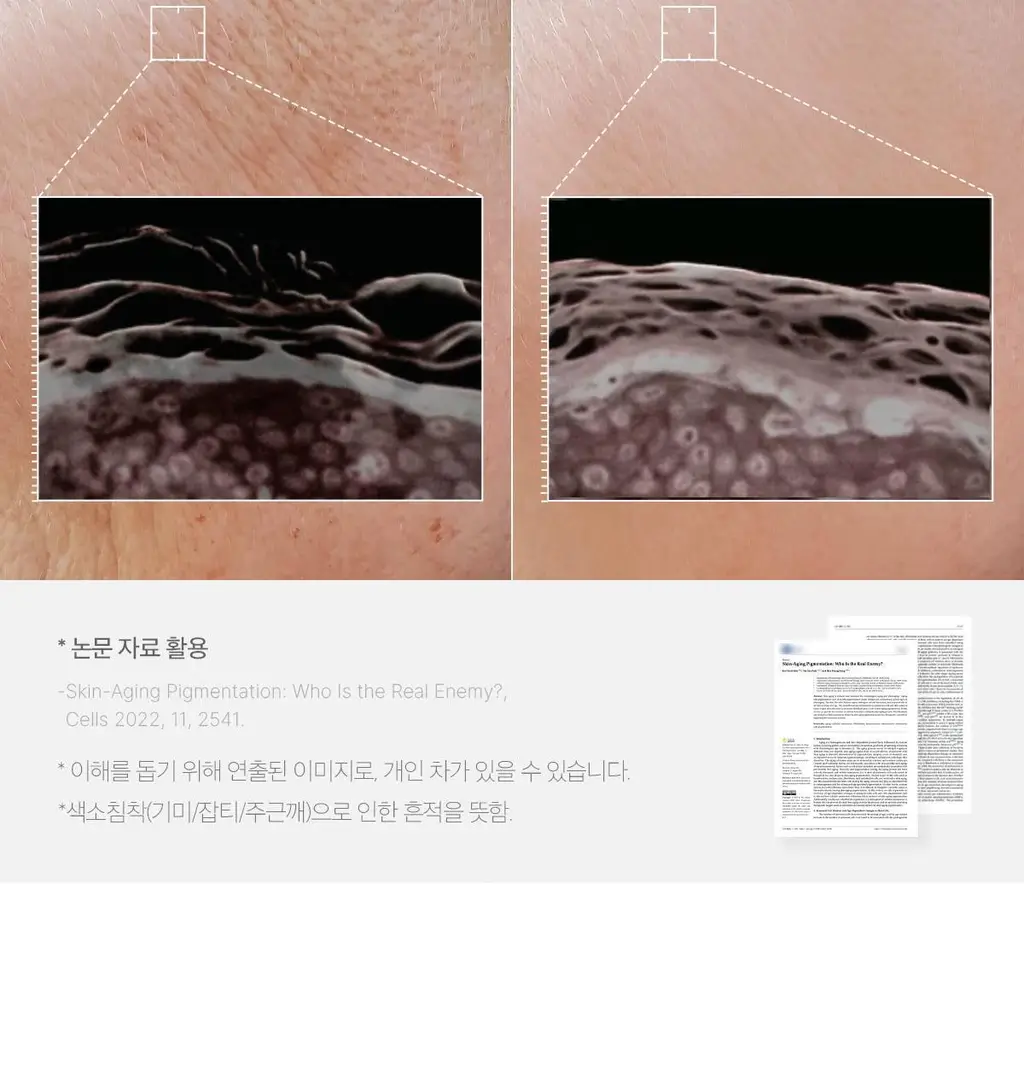 [흔적미백] 메디큐브 연어 PDRN 핑크 앰플 30ml 상세페이지 26